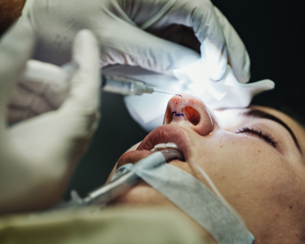 rhinoplasty process photos for allure.com's life in plastic column